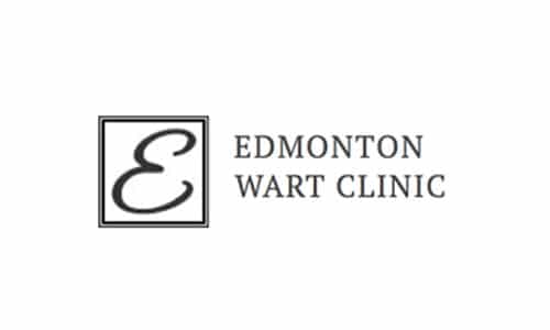 wart treatment edmonton